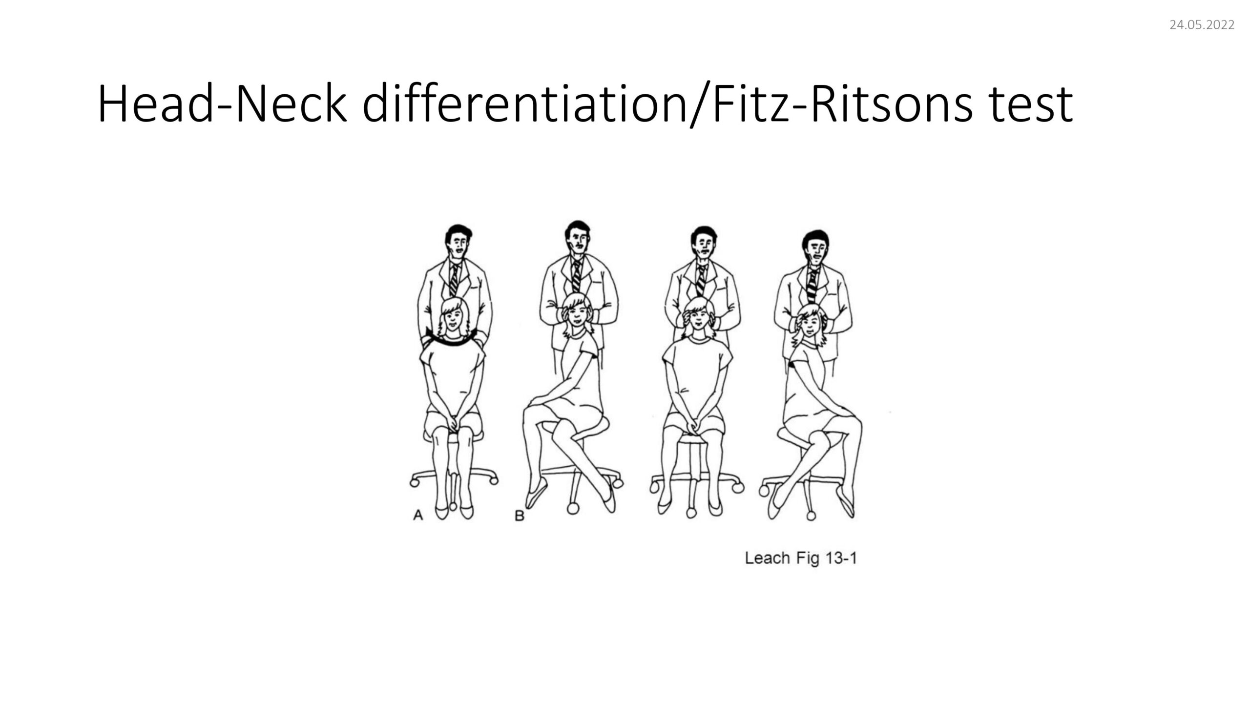 Head_Neck differentiation/Fitz-ritsons test
